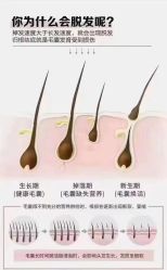点击看大图 -舒欣头疗·俏丝谧语 白发脱发专业护理