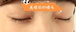 -宥莉·ULLY 痘敏肌•科技皮肤管理中心