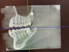 -土豆口腔(凤凰北总店)