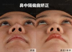 -北京米扬丽格医疗美容·联合丽格鼻整形中心