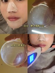 -宥莉·ULLY 痘敏肌•科技皮肤管理中心