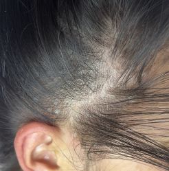-清疣美疣·痣·斑净肤中心