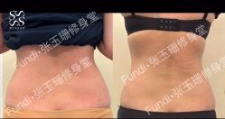 -Fundi张玉珊修身堂·indiba·BTL科技瘦身
