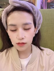 体验后-正璞医疗美容·皮肤修复·微整注射