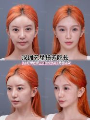 -深圳艺星医疗美容医院
