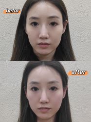 -颜和骨正·明哲式骨相美学整骨
