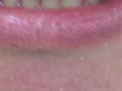 -极光口腔·矫正种植修复(锦江院区)