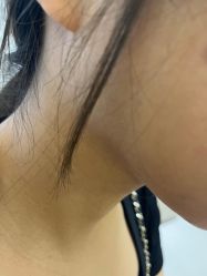 -美瑞莎创美医疗美容