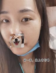 体验后-北京炫美医疗美容