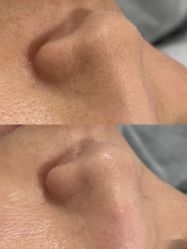 -SKIN79皮肤管理中心