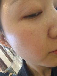 -长沙雅美医疗美容医院