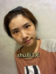 -广州健丽·去眼袋医疗美容机构