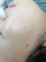 -清疣美疣·痣·斑净肤中心