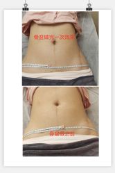 点击看大图 -贝美佳产后修复中心
