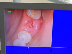 -爱贝口腔·牙周诊疗·种植修复中心