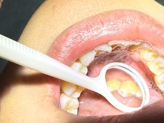 -土豆口腔(凤凰北总店)