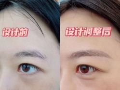 -悦汐颜美肌抗衰中心