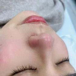 -元熙兰积皮肤管理