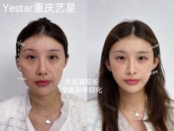 -Yestar重庆艺星医疗美容医院