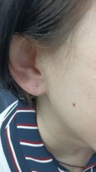 -Wisezone唯点穿耳打耳洞专业国际连锁品牌