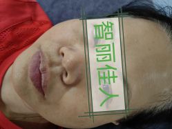 -智丽佳人祛斑祛痘美容美体
