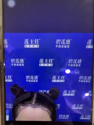 -碧莲盛·不剃发植发