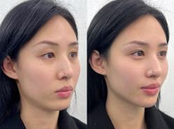 -广州曙光医学美容医院