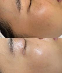 -美愈美肤MEIYU SKIN