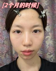 -素美医疗美容·西南眼鼻整形·修复基地