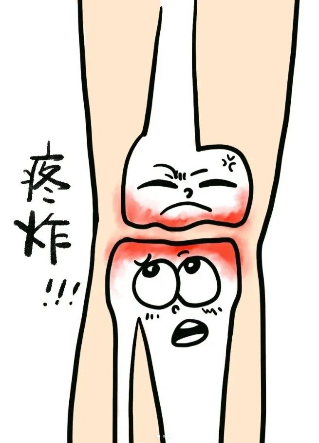 膝盖痛?感谢中医艾灸助我上岸!
