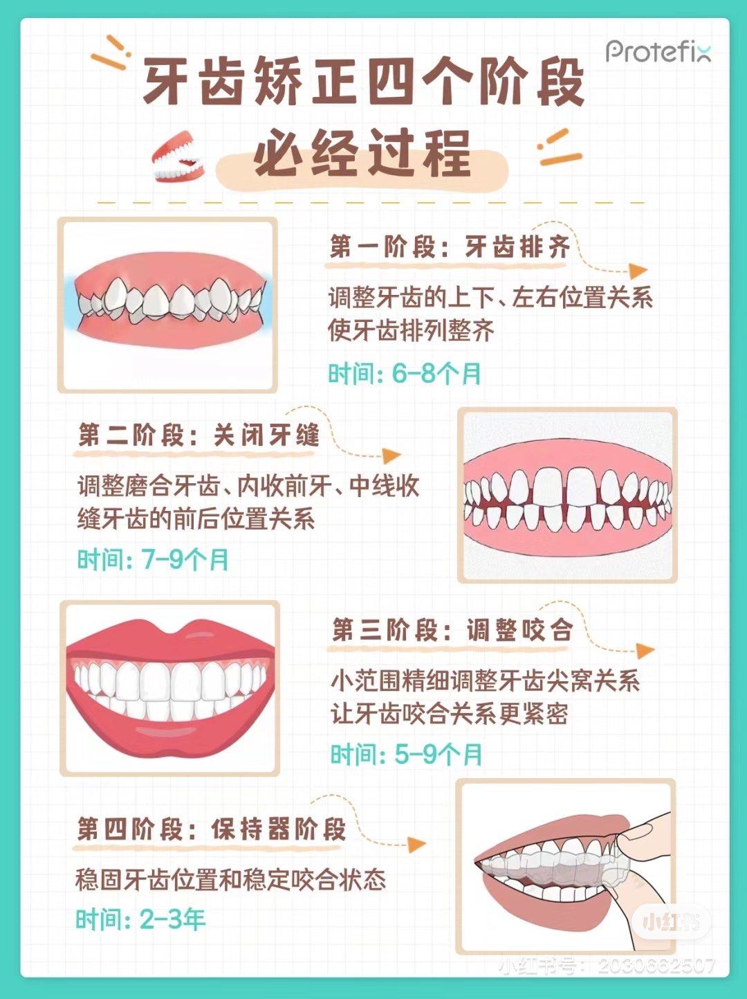 牙齿矫正的过程