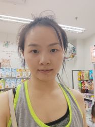 体验后-上海漾颜医疗美容