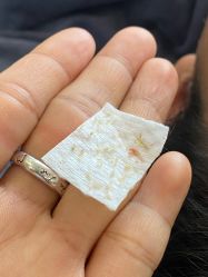 -瑶芳清颜草本祛痘