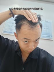 -雍禾植发全国连锁