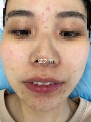 -小忠丽格医美