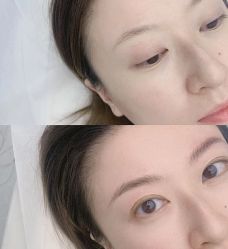 -德绣·机器野生眉发际线·美瞳线半永久