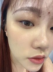 -YooMee优美智能科技美肤机构