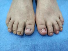 -世龙世家甲沟炎·灰指甲·嵌甲矫正·修脚(武侯区双楠店)