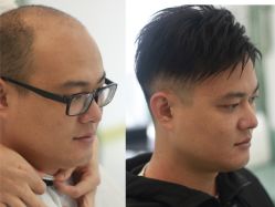 -发饰美男士增发补发假发定制店