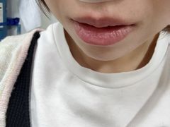 -杭州仁易堂中医康复医院疤痕修复