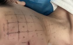 -杭州医巢医疗美容