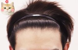 -大麦微针植发丨全国连锁