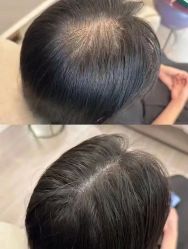-希梵尔头皮抗衰·科技养发
