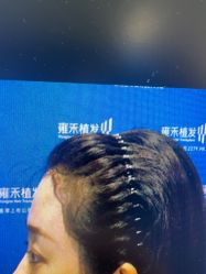 -雍禾植发全国连锁