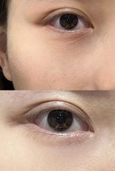 -清华大学玉泉医院-医疗美容科