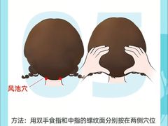 -北京华德眼科医院