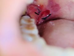 -华中科技大学同济医学院附属同济医院(汉口院区)