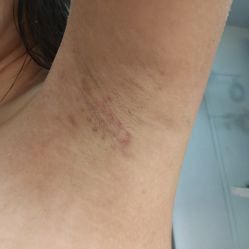 -广州美莱医疗美容医院