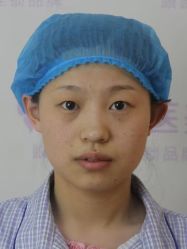 体验前-紫洁俪方（北京）医疗美容