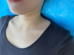 -颜蕾医美黄金微针水光美肤玻尿酸抗衰中心